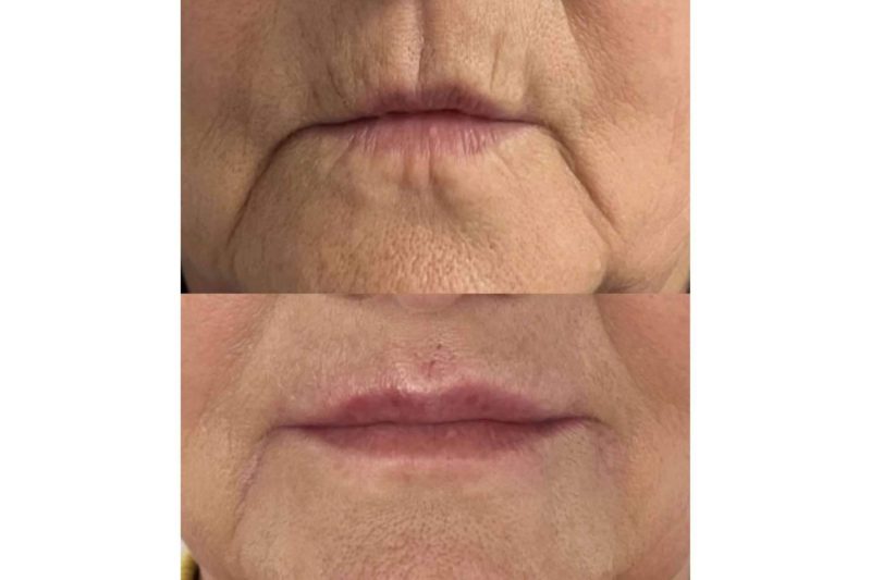 Img 60a691e0fc9bb748bcaacbd857ce