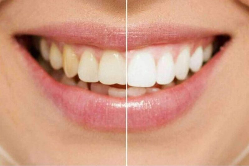 Img 8fd20adb425f152d045fae555c23d56a