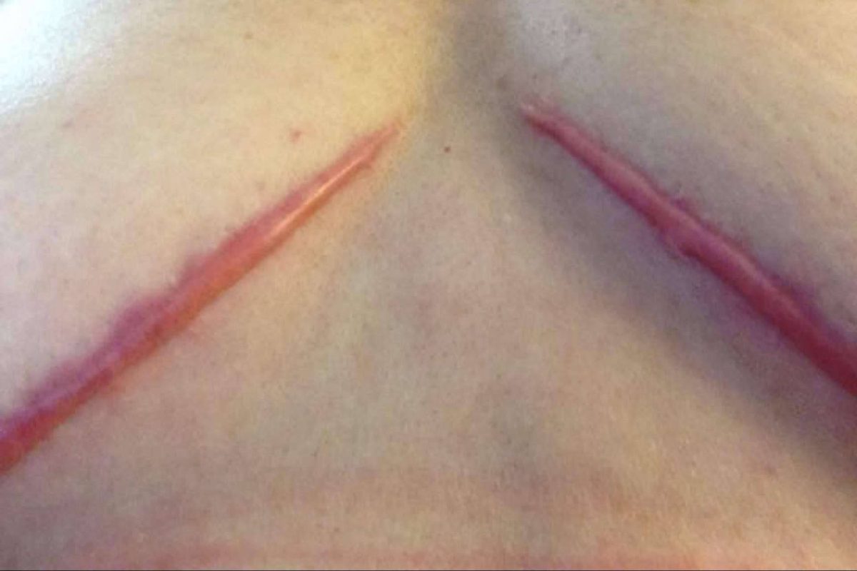 Img Cabd1d6ebff64e508dd02a67dee1fd