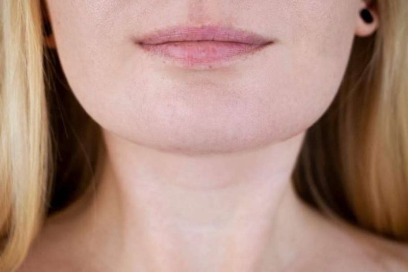 Img 76969294862af09ff89945c4f79f0b6d