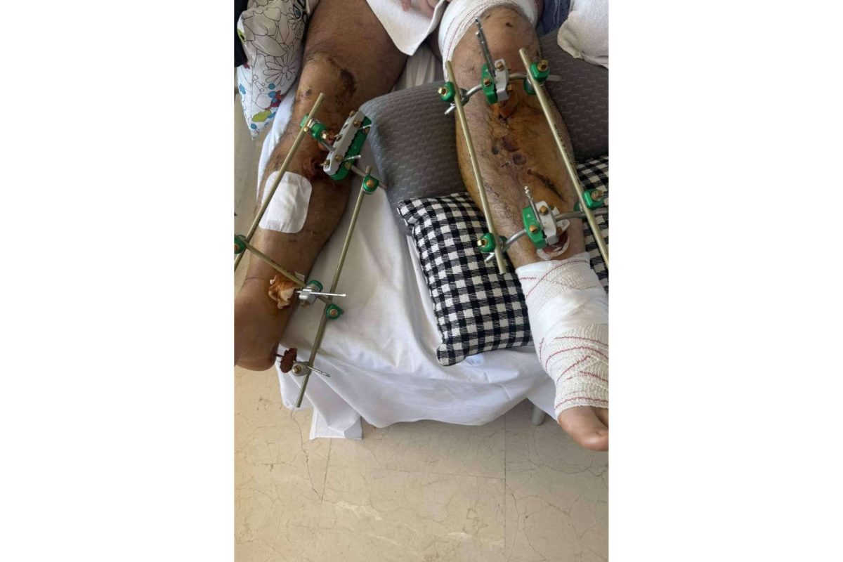 Img Db1ffda07632ccbba96203a23eba