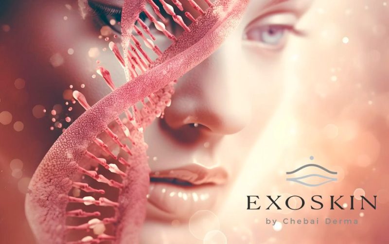 Exoskin